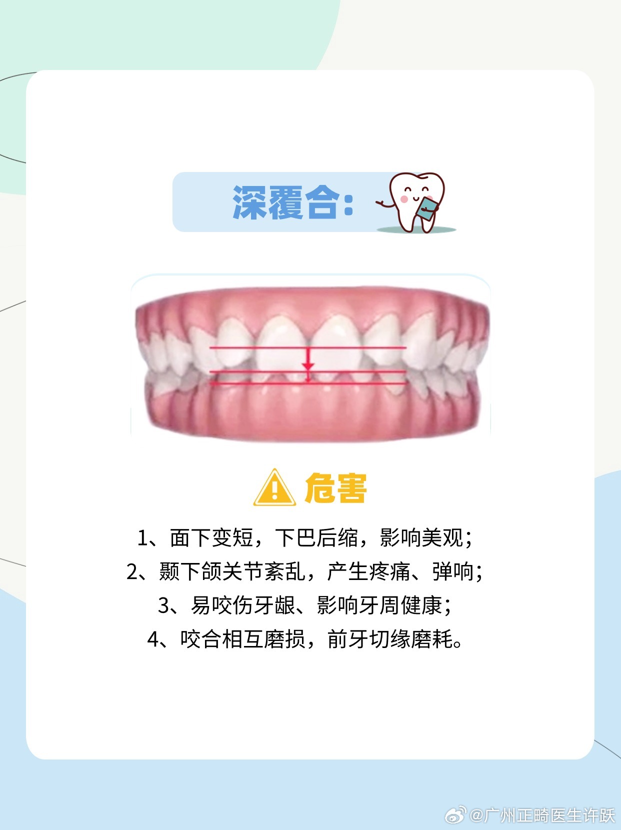 广东省口腔医院深覆合治疗解析