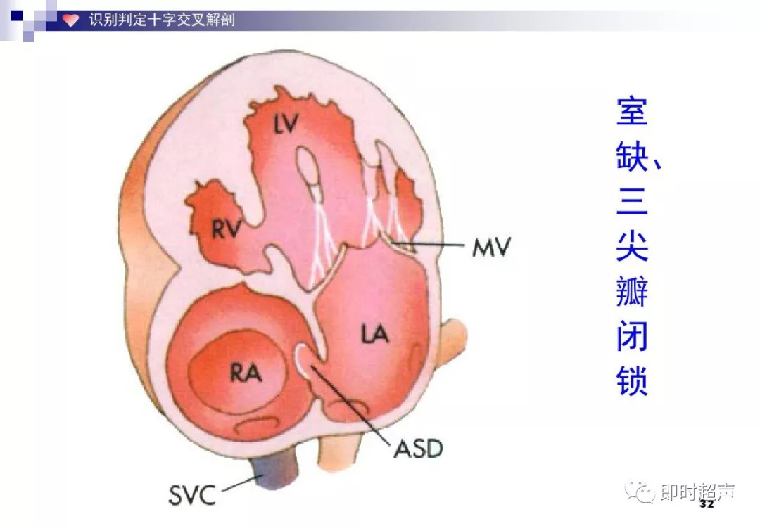 五个月宝宝心脏杂音，关注与理解