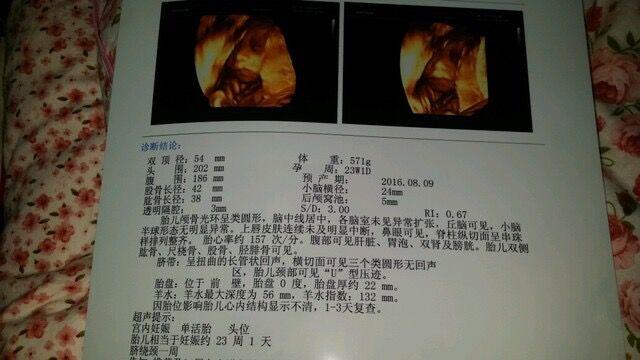 三个月胎心158，生命的奇妙之旅